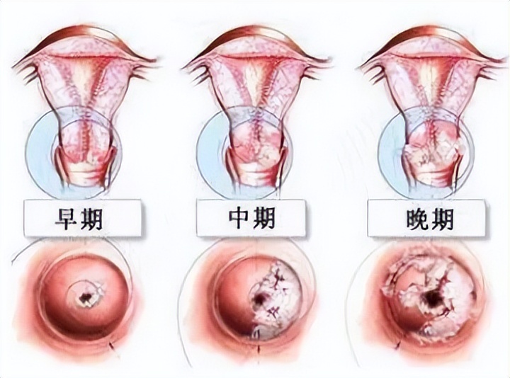 女生底裤发黄发硬怎么回事,女性裤头发黄是什么原因
