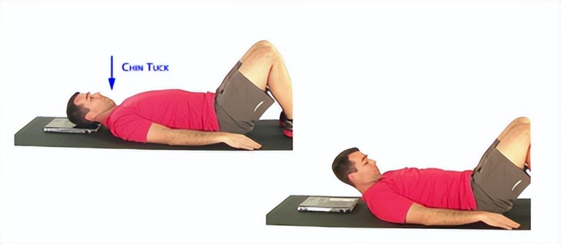 颈复康治疗颈源性头痛吗,颈源性头痛整体解决方案