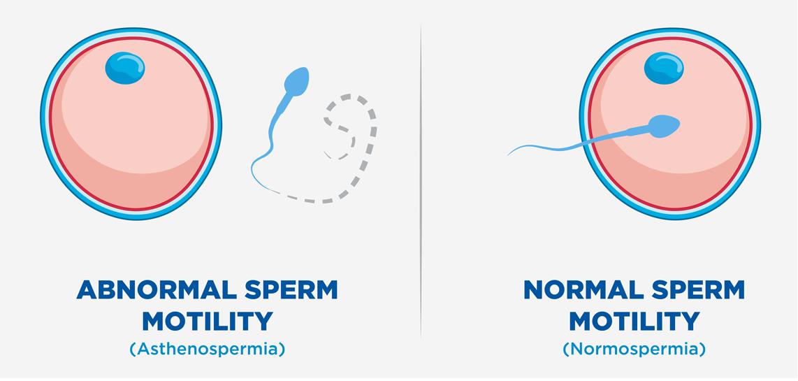 4000万精子“赛跑”，只有一颗胜出，失败的最后都去哪了？