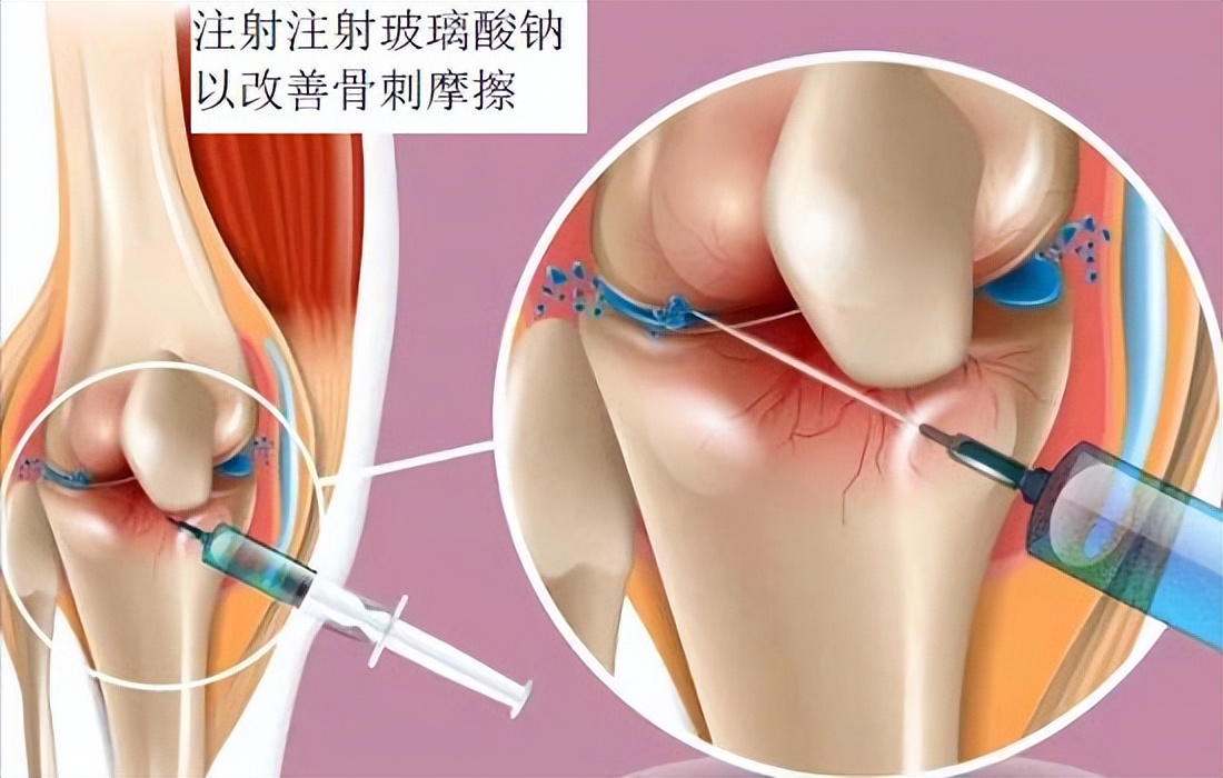 腿脚酸软无力的原因和解决方法,腿脚无力是什么原因