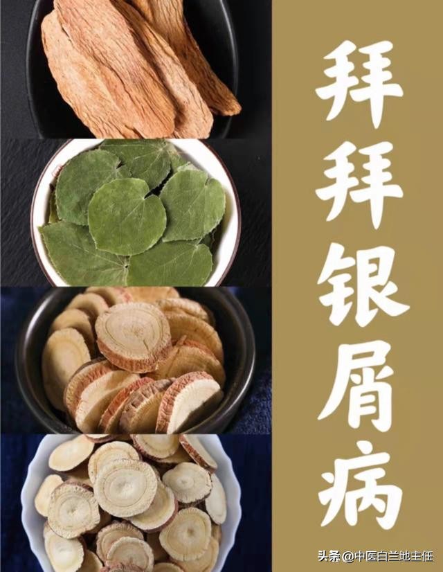 有关银屑病的故事,中医治疗银屑病故事