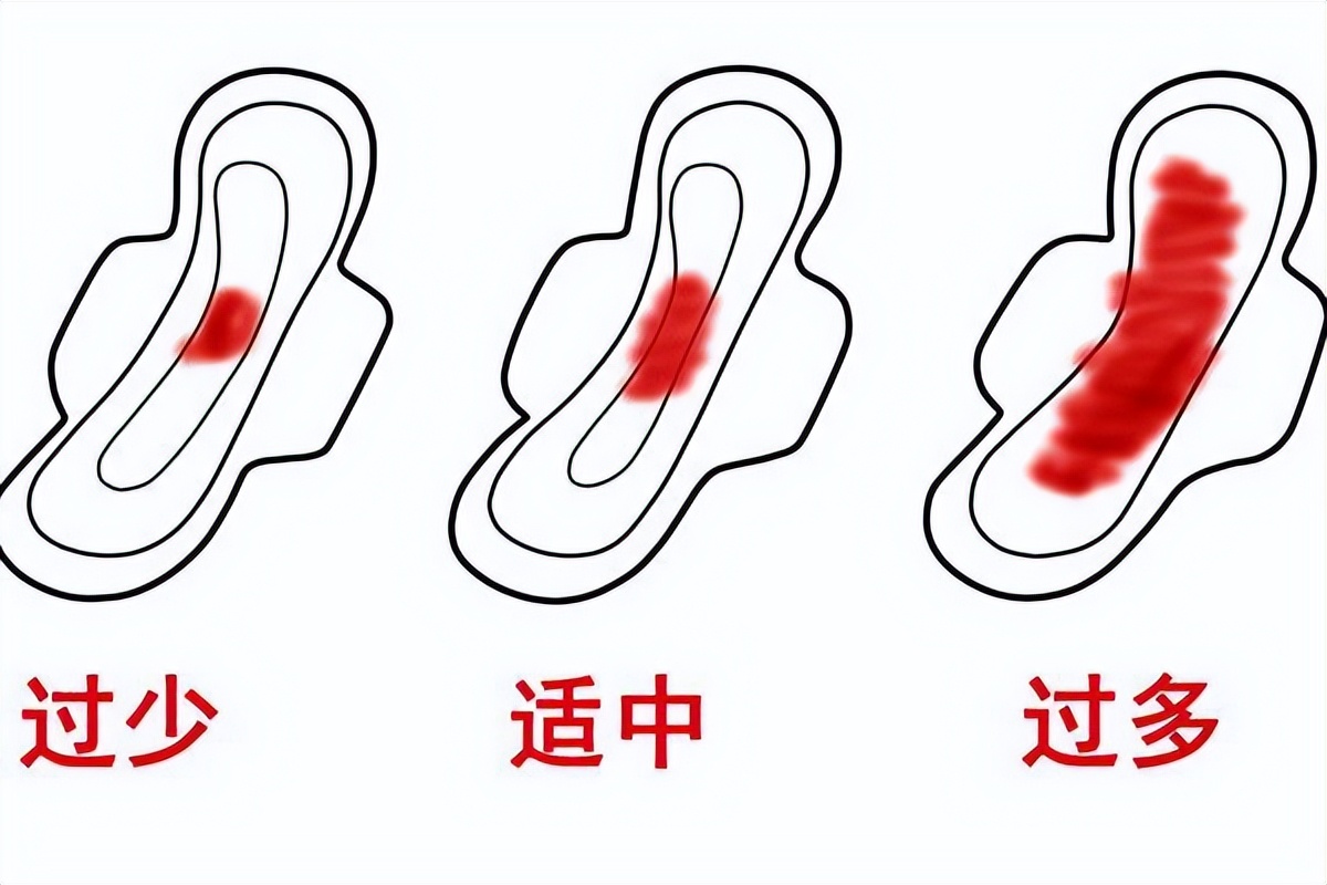 大姨妈准时来但量少发黑怎么办,大姨妈量少发黑持续十几天