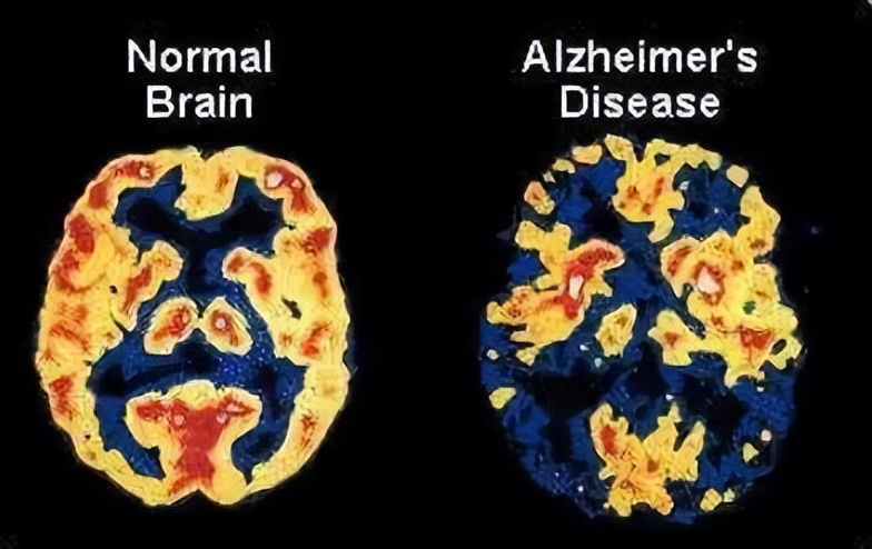 诺奖得主揭秘人类进化,诺奖得主谈长寿