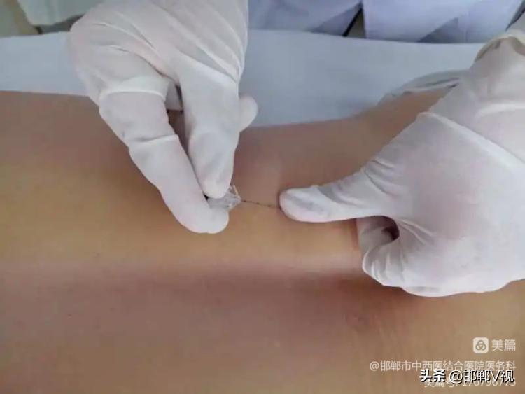 邯郸市中西医结合医院有哪些,邯郸市第一医院中西医结合科门诊