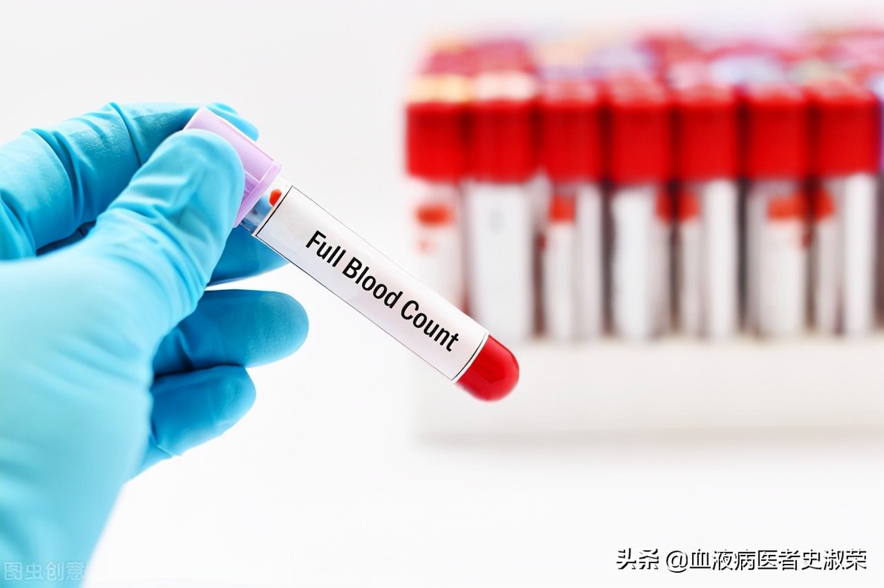 血小板30但无任何症状怎么回事,血小板减少有什么症状吃什么药好