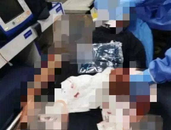 港星黄竣锋被捅伤,对方说认错人了,上次任达华受伤,也说认错了