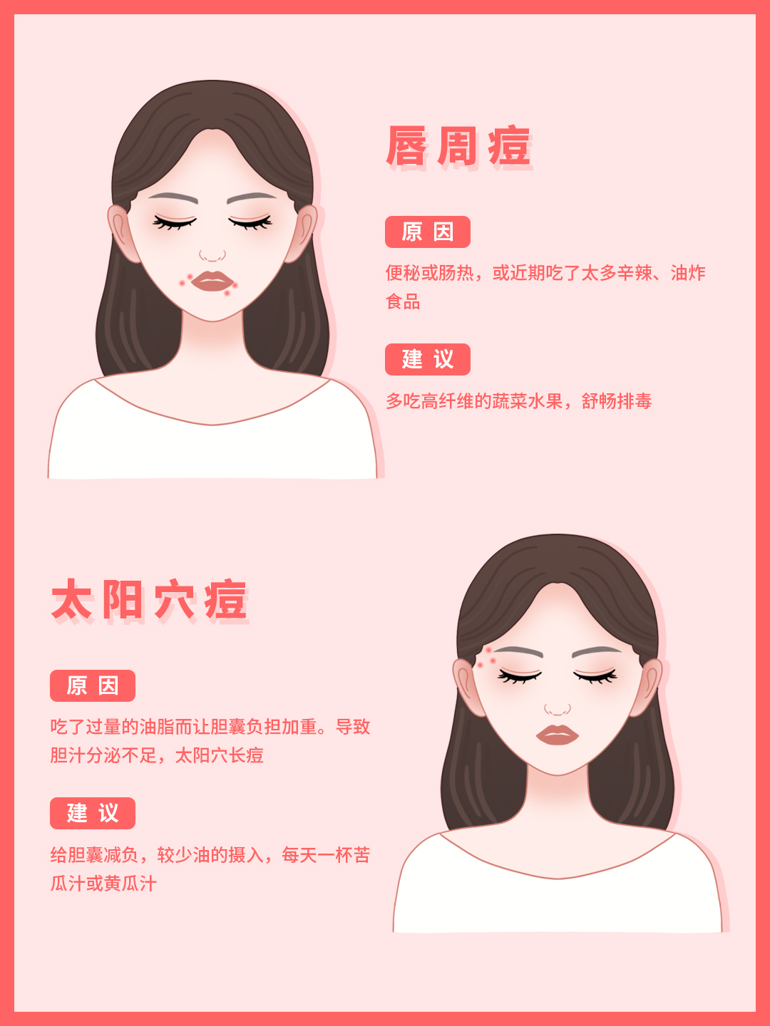 脸颊总是长痘的原因和治疗方法,脸部各部分长痘原因及解决方案