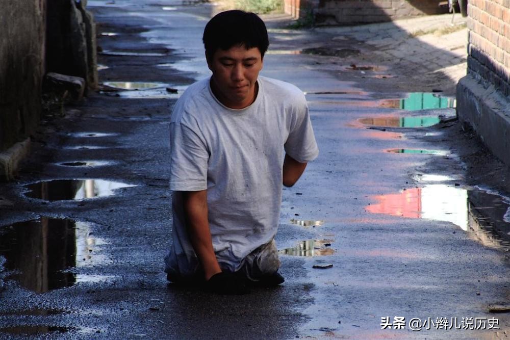 男子惨遭核辐射,男子因核辐射致残