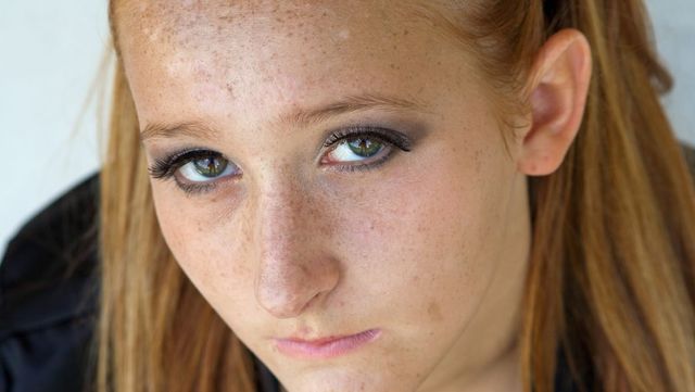 淡化脸上斑点改善暗黄,皮肤暗黄无光泽有点斑点怎么内调