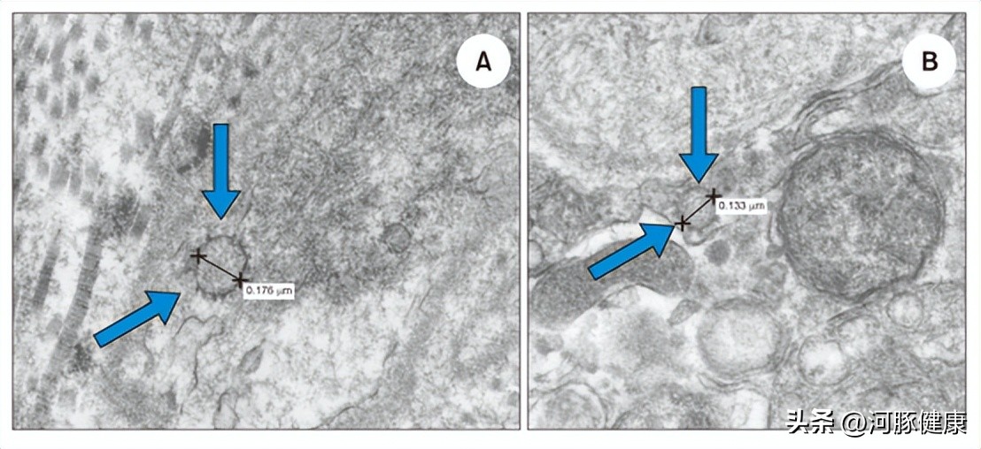 男的阳了会怎么样,男的阳了会有什么后遗症