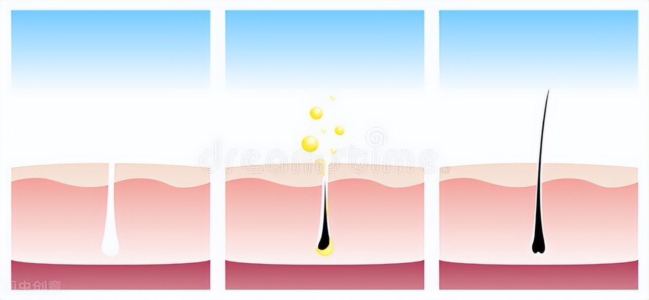 用哪一种米诺地尔可以治疗脱发 (治疗脱发育发的药物排行榜前十名)