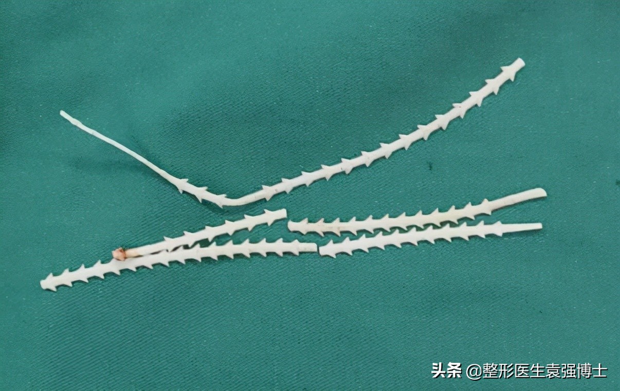 45岁脸下垂怎样锻炼变好看,45岁脸部下垂怎么补救