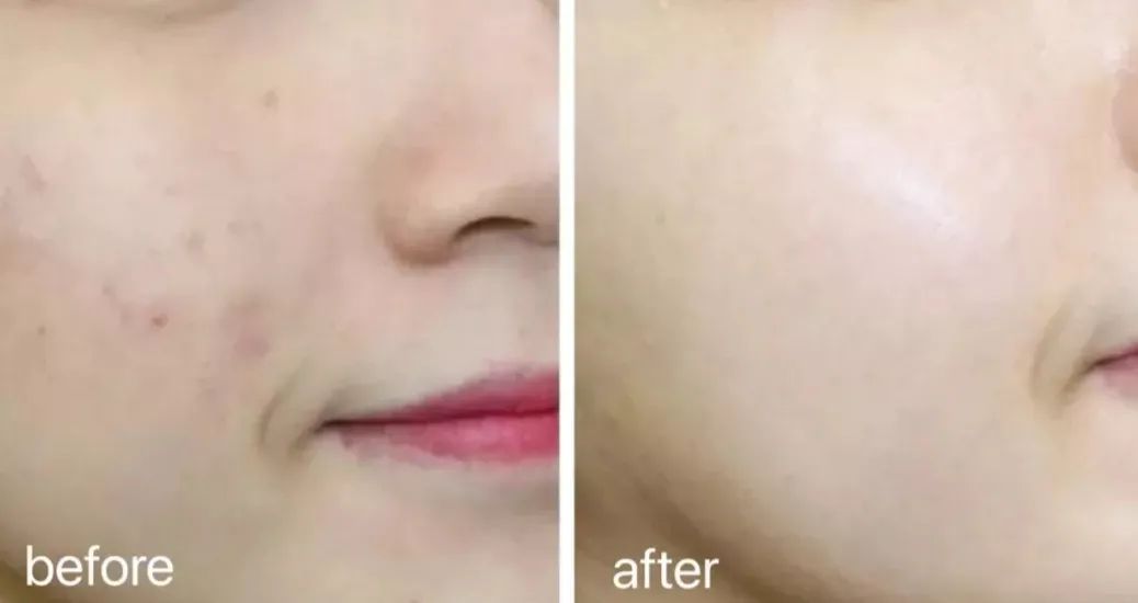 海蓝之谜活颜焕肤精华油,海蓝之谜lamer璀璨焕活精华油30ml