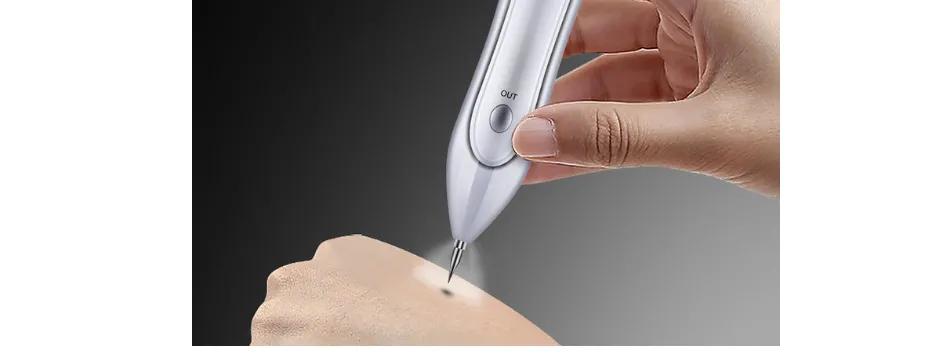 洗纹身真的不是一般人能承受的,洗纹身真的要下很大的决心