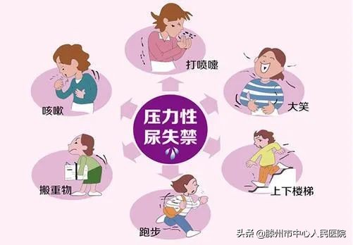 保卫女性健康,如何预防女性压力性尿失禁