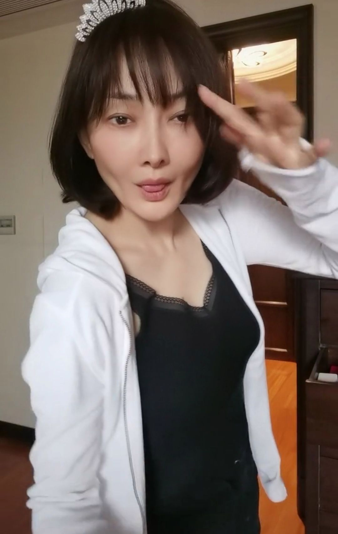 最失败硅胶脸的女星,硅胶脸女明星排行