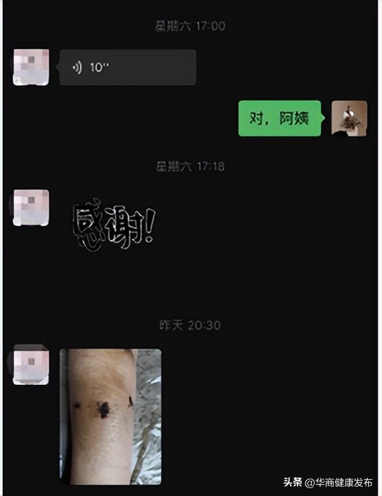 微创腹腔镜是什么,腔镜手术皮下隧道恢复时间