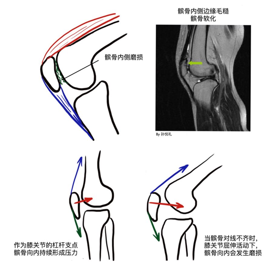 在家待久了脚痛,在家待久了胳膊关节痛