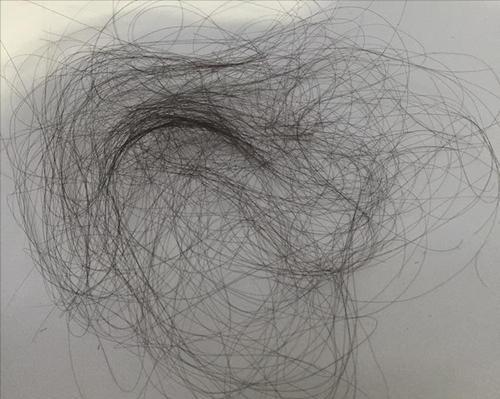 头皮长疙瘩和脓包怎么回事,头皮长脓包是怎么回事啊