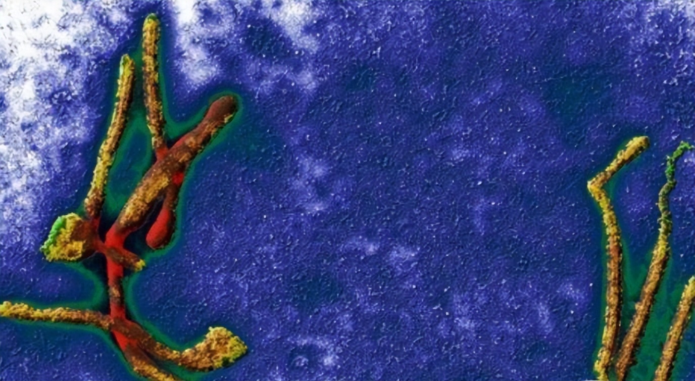 世界上最致命的病毒九种,细菌和病毒哪个更致命