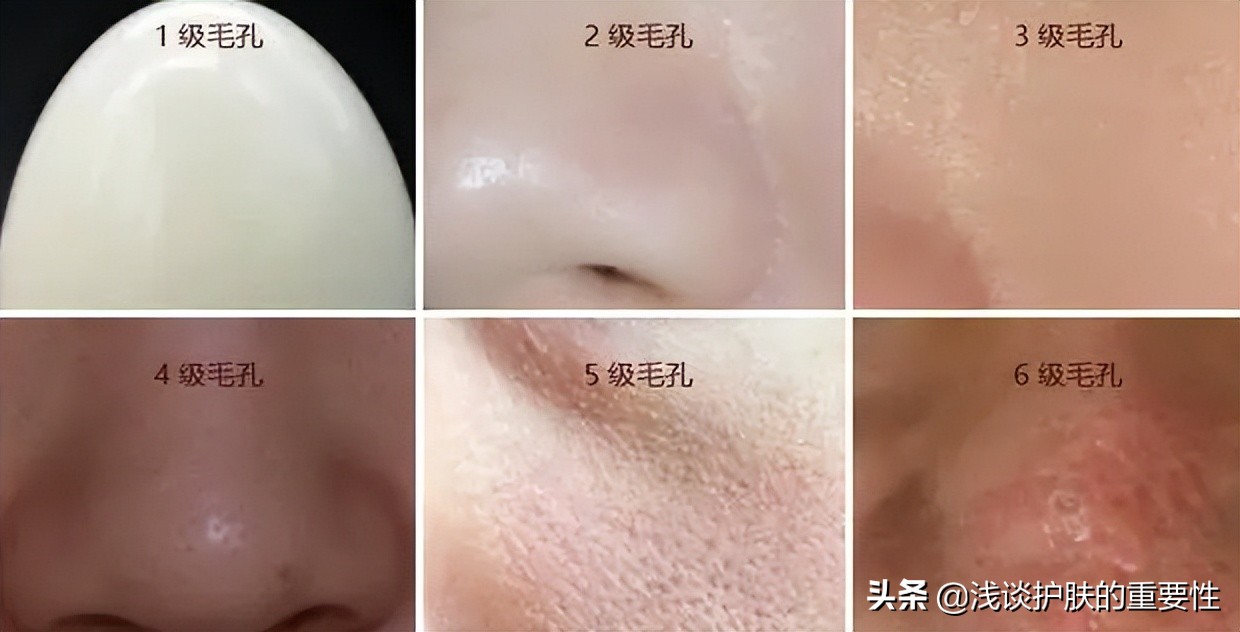 男人脸上毛孔粗大用什么护肤品,男人脸上毛孔粗大用什么护肤品好