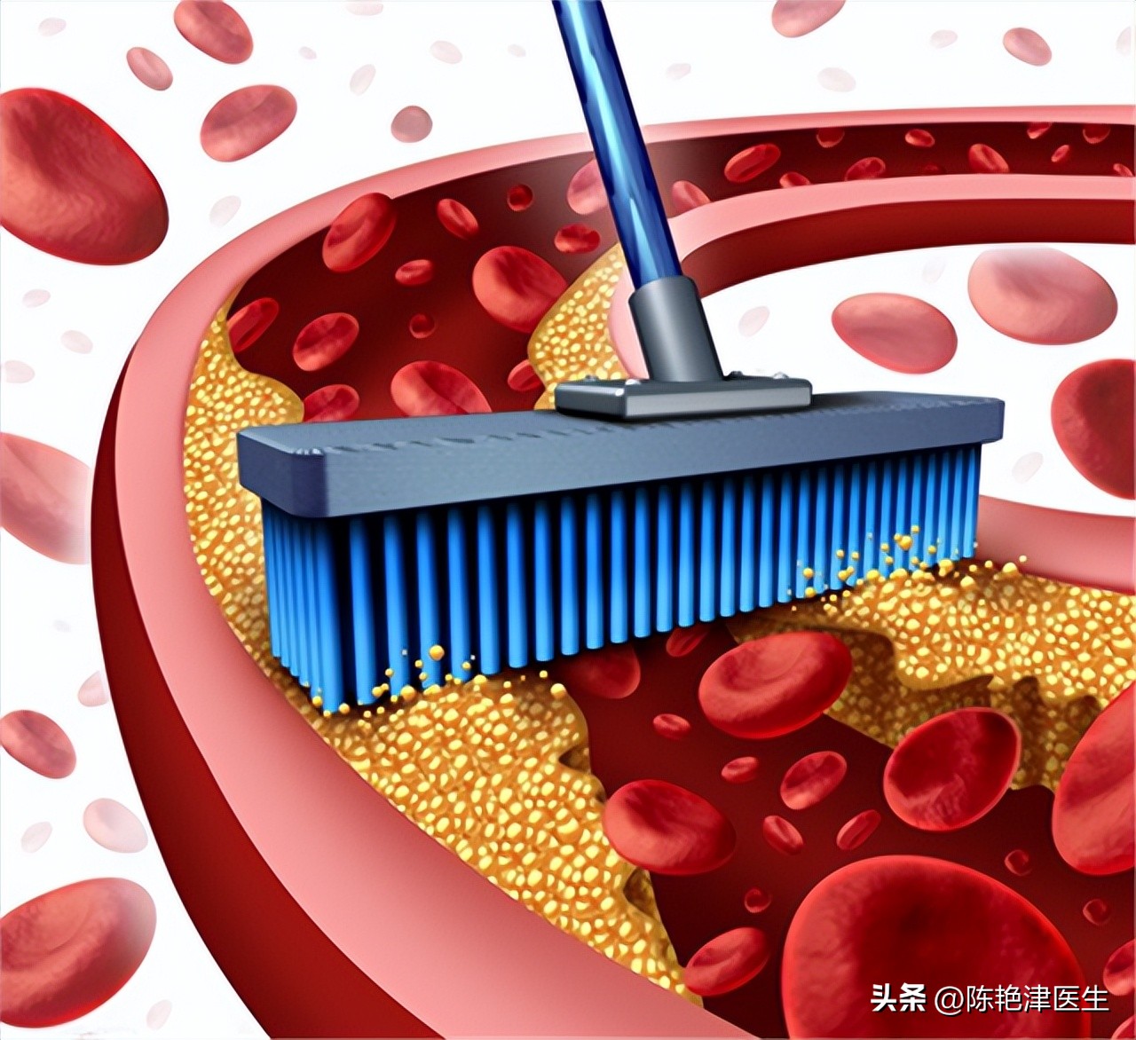 血脂高多少需要吃降脂药,血脂多高需要服用降脂药