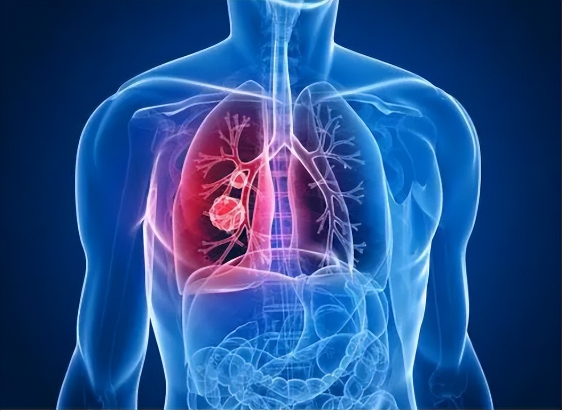 心血管疾病有哪些症状及治疗方法,心血管病有最好的治疗方法吗