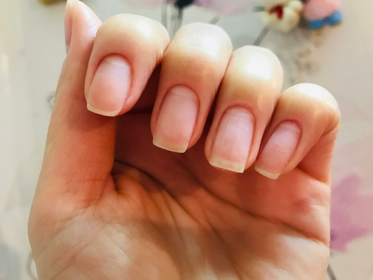 指甲有凹凸的波浪纹是什么原因,指甲渐变有条纹怎么解决