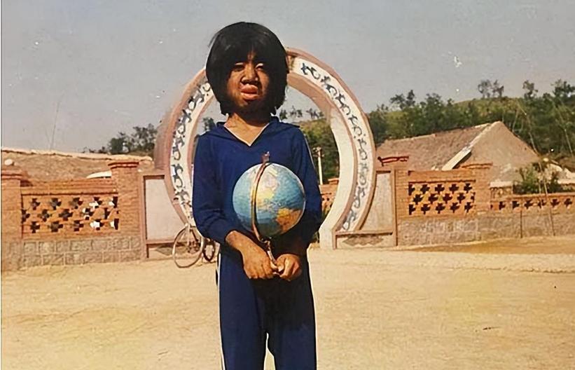 当年轰动一时的“毛孩”：42岁娶90后娇妻，生下一子未遗传长毛