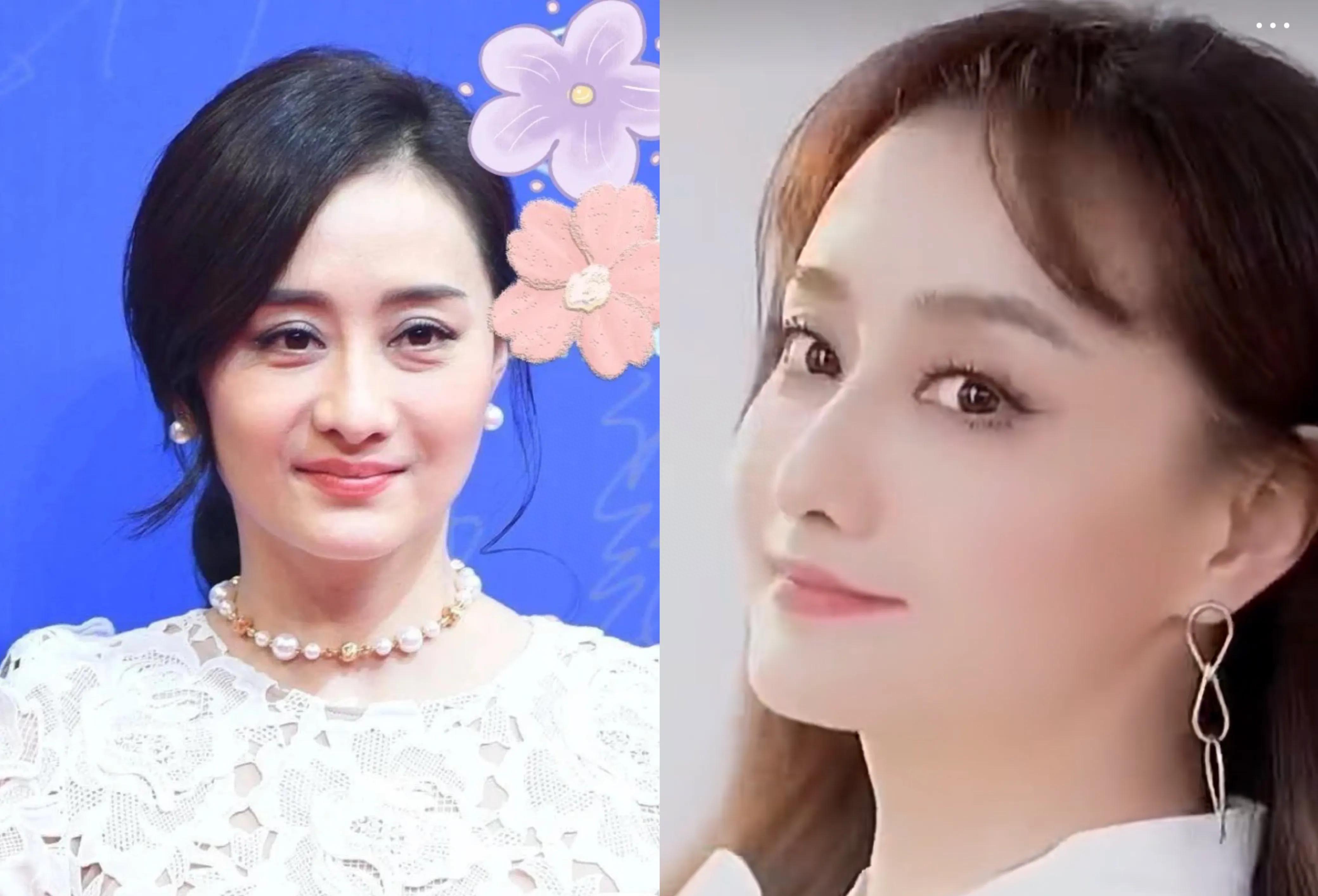 女明星集体回春做了什么医美,女明星集体回春