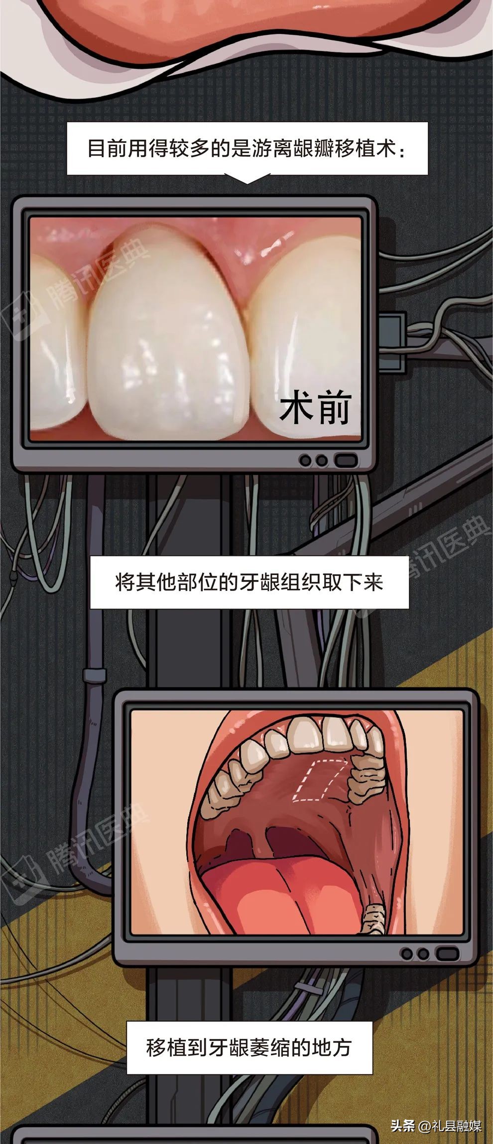 牙缝隙大吃菜就塞牙怎么修复,牙齿吃菜老塞牙怎么办