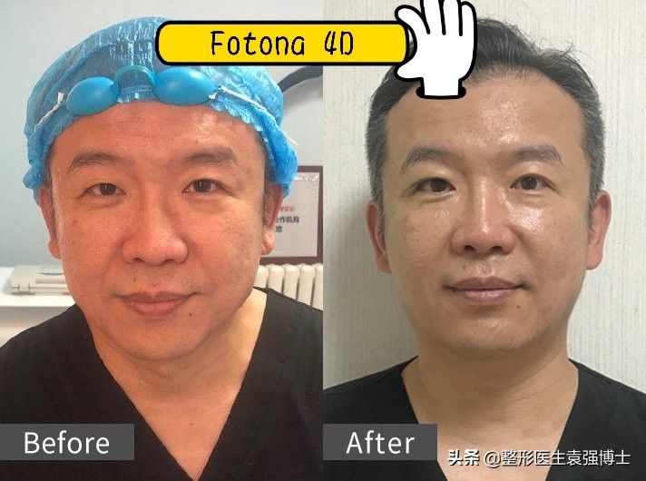 50岁女人看起来像三十岁吗,女人40岁应该做的医美项目