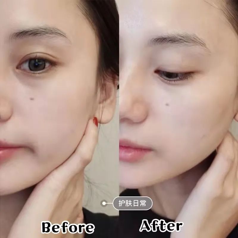 olay玉兰油套盒适合敏感肌吗,olay玉兰油美白水乳套装测评