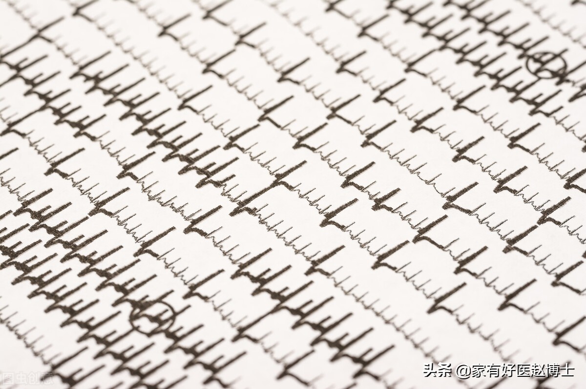 心脏早搏怎么治疗和预防,心脏早搏怎么知道轻微还是严重