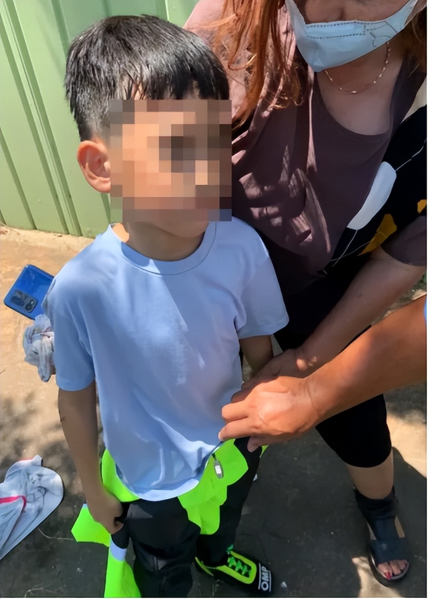 林志颖开特斯拉车祸后伤势严重!面部骨折做整容手术,儿子受惊吓