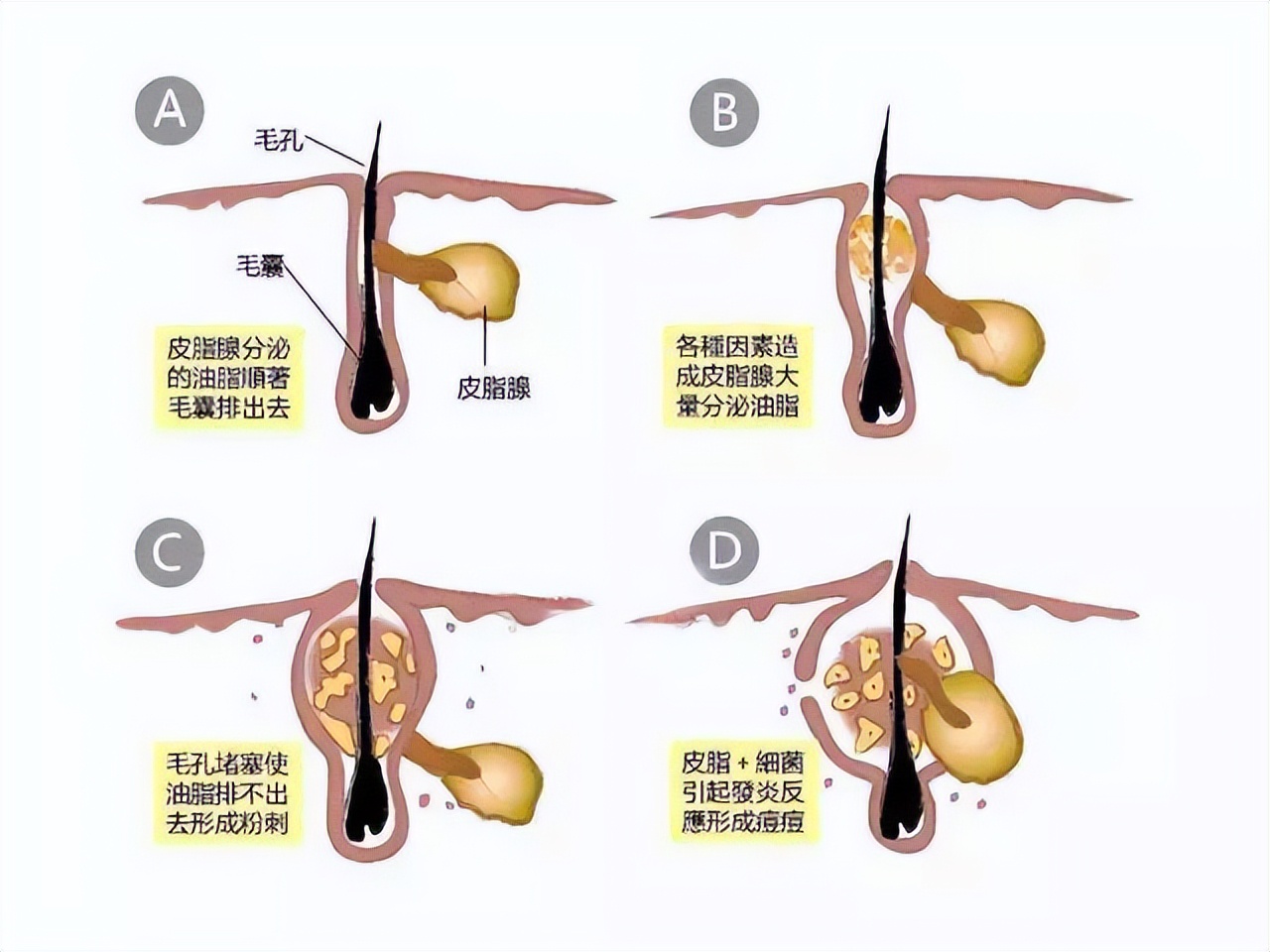 十个绝对有效的控油密招,皮肤控油7步走第4步很重要