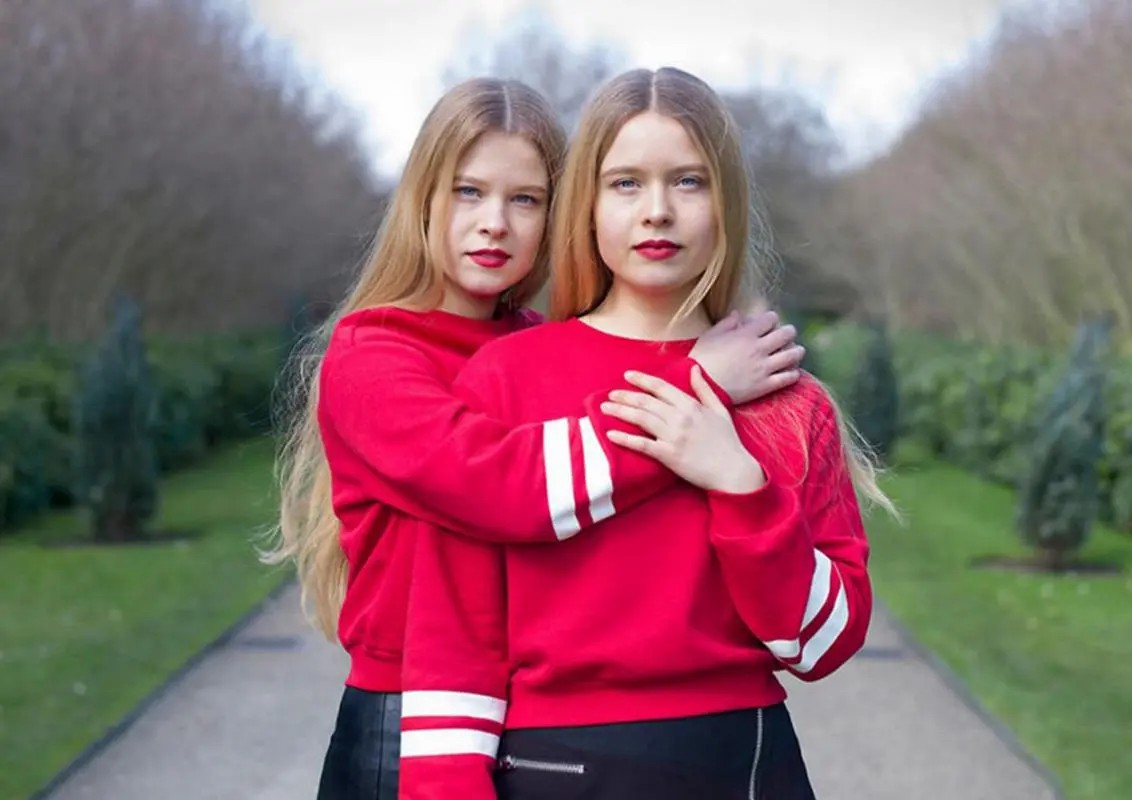 连体人是怎么诞生的,为什么会有雌雄连体人