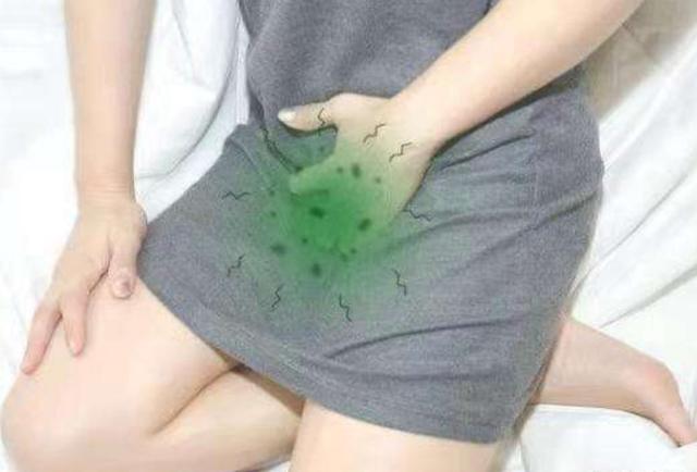 女生内裤上有什么健康信号,内裤有炎症的表现