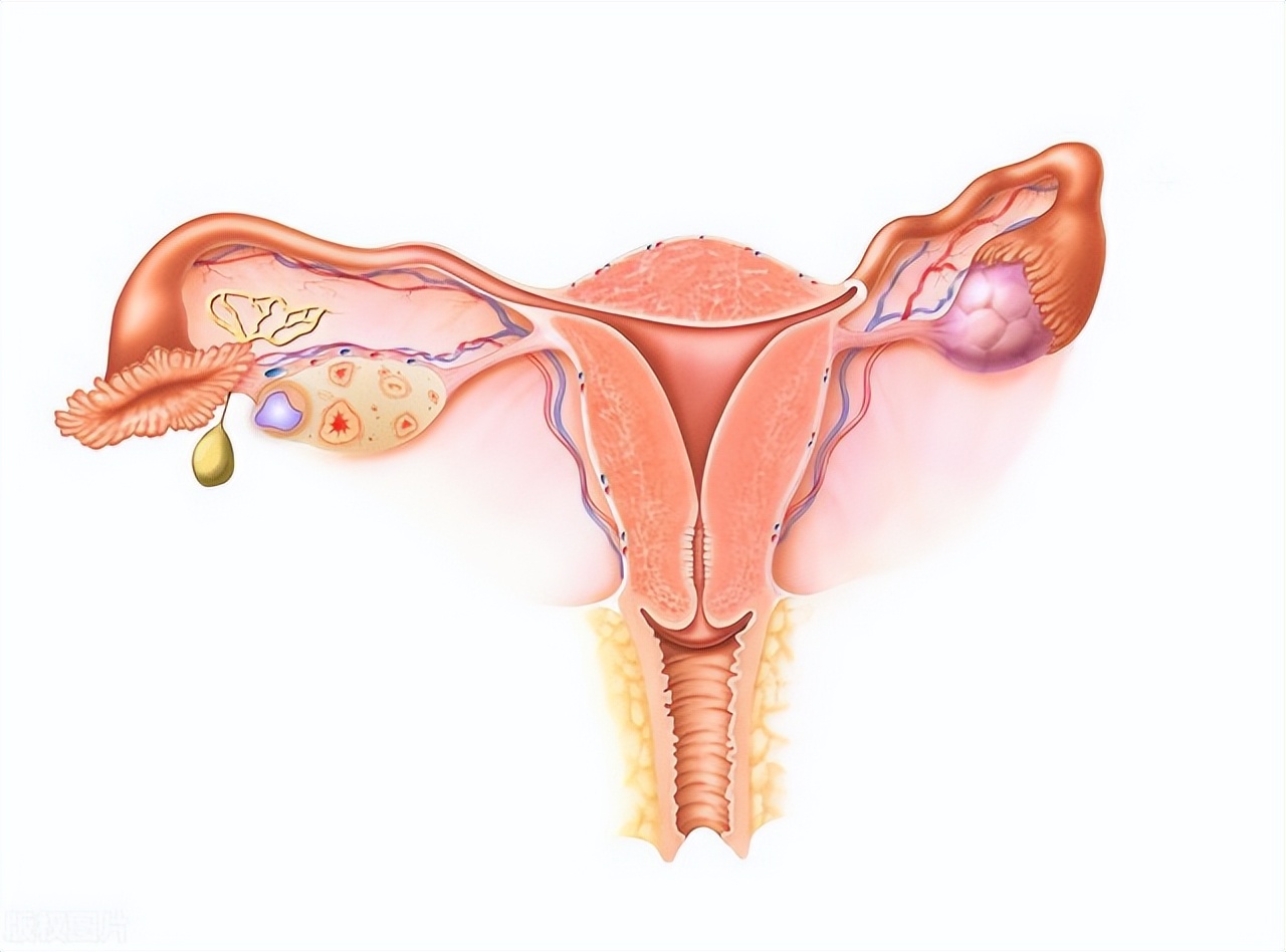 女性“巨阴症”,就不能够生育吗?医生提醒:主要看2种情况