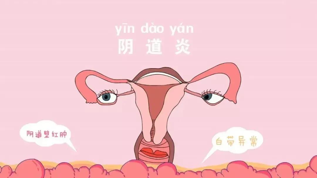 白带是鱼腥味的是怎么回事,白带有鱼腥味是什么原因