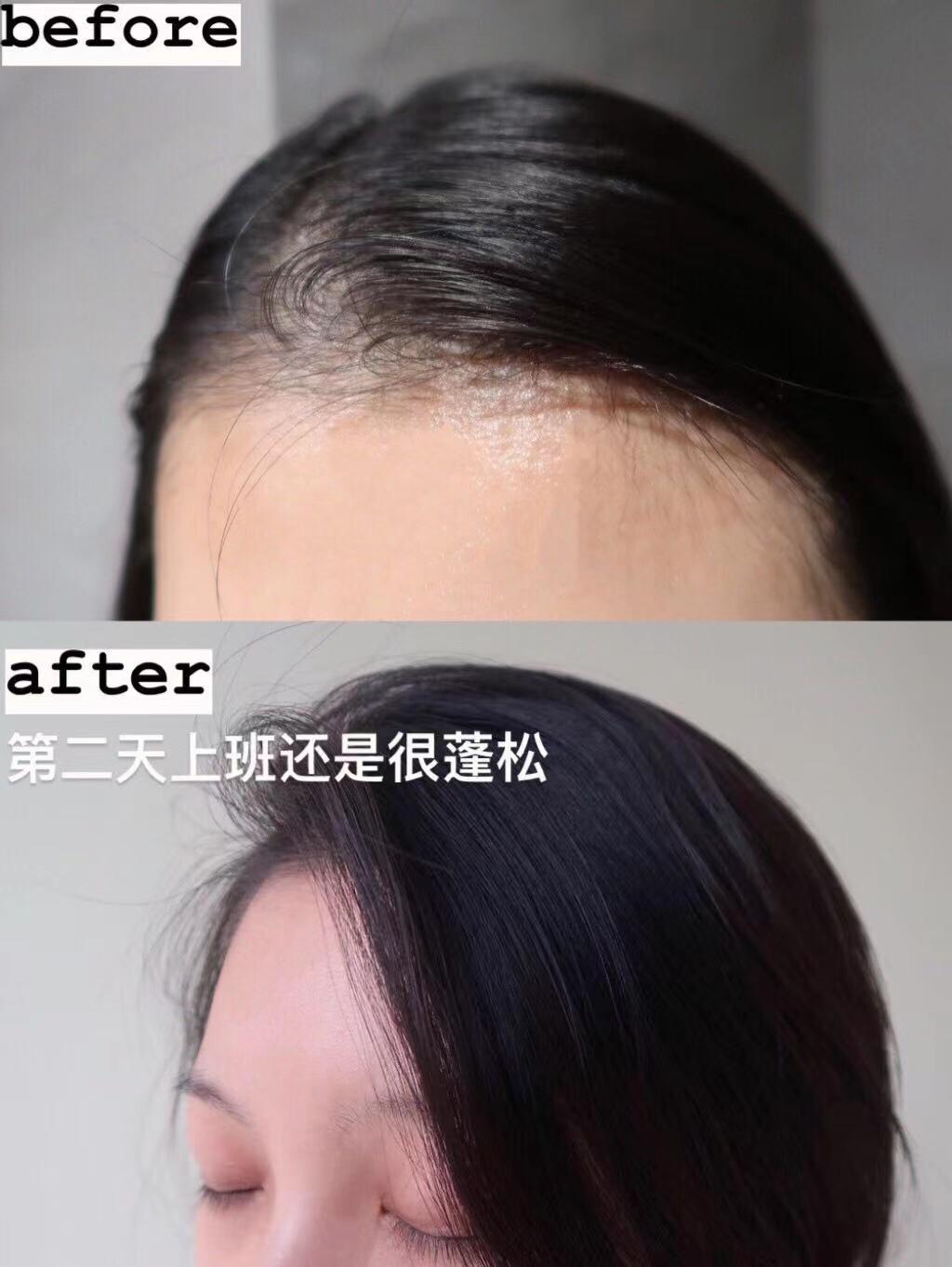 洗发水满婷控油,舒蕾防脱洗发水推荐