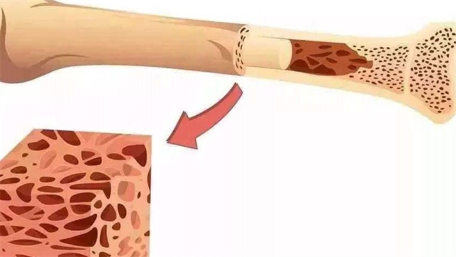 骨头对于人体来说是非常重要的,如果人体没有骨头会怎么样