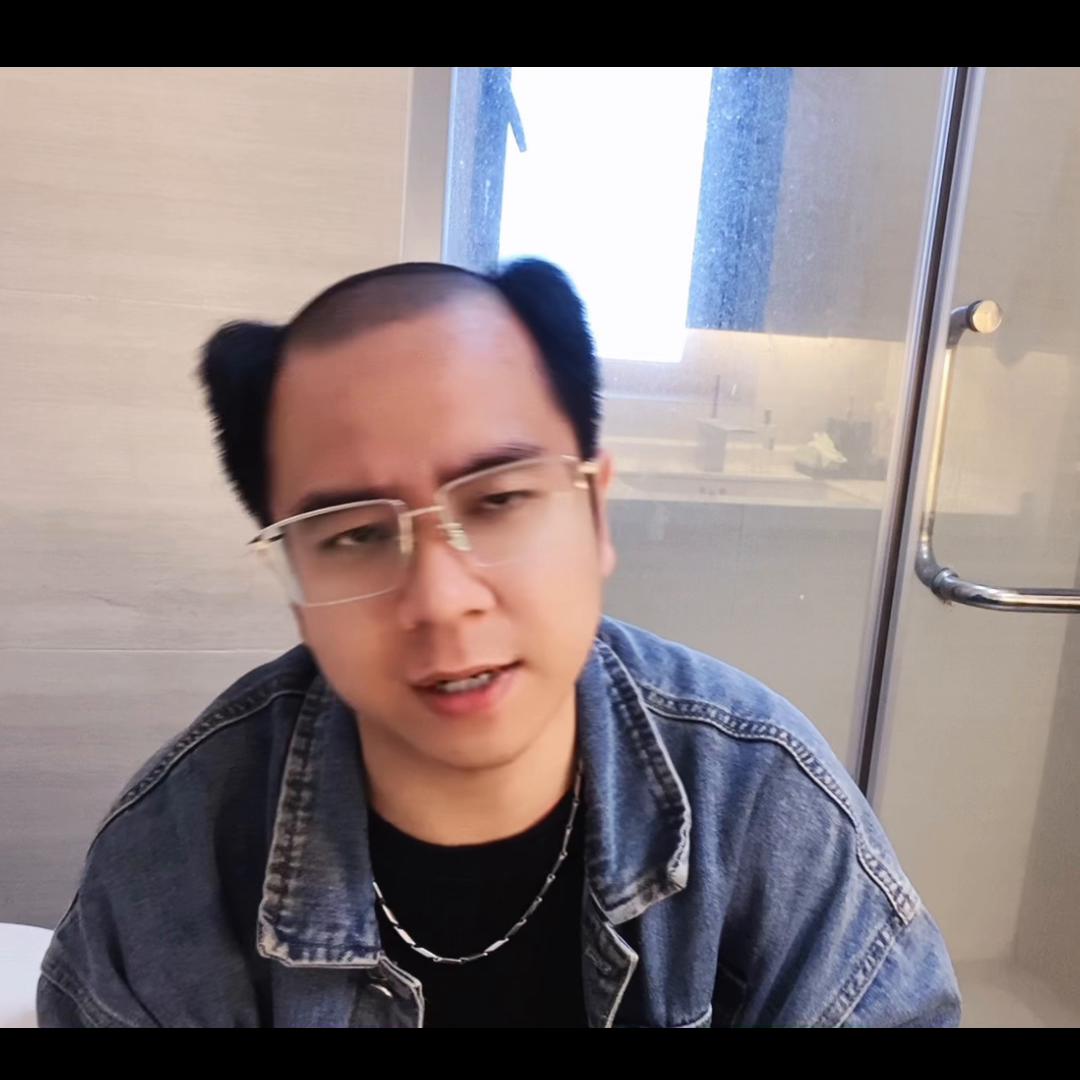 做个帅气的假发该花多少钱#沙僧补发#无痕补发#深圳补发