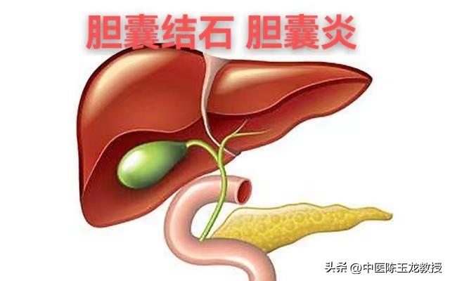 胆囊炎胆囊息肉胆结石中医偏方,胆囊炎胆结石胆囊息肉吃什么药好