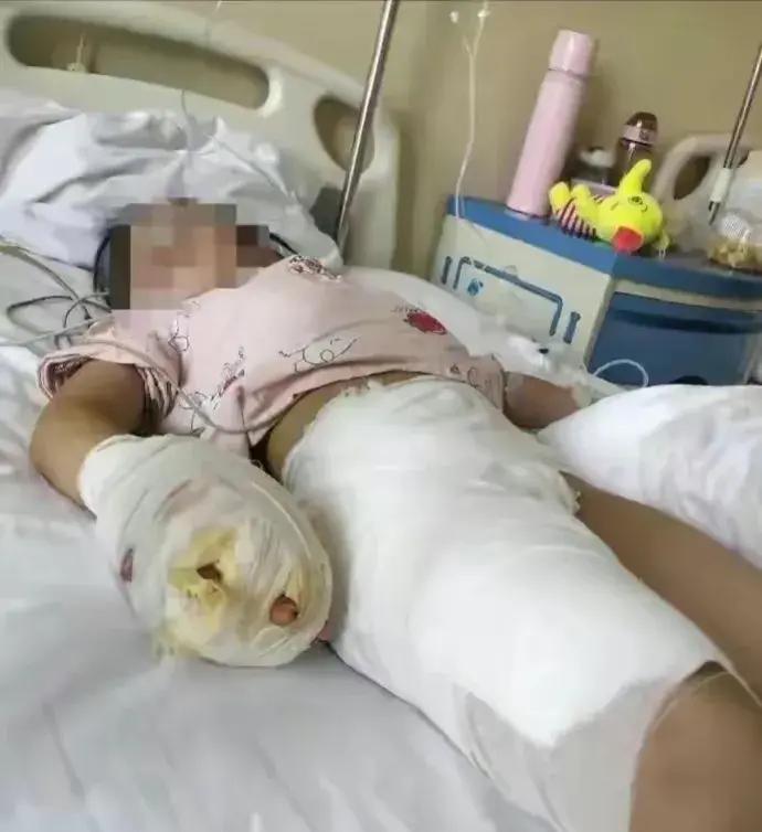 残忍的女孩遭妈妈暴打,女童遭生母残忍虐待