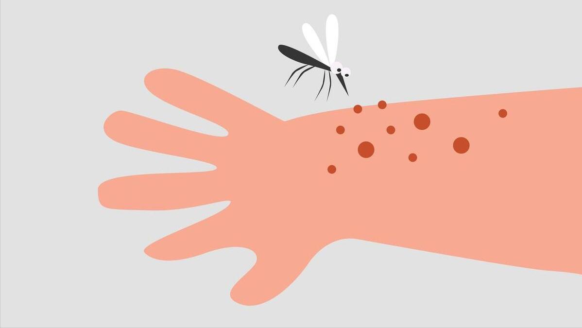 炉甘石洗剂多钱,不同牌子的炉甘石洗剂功效一样吗