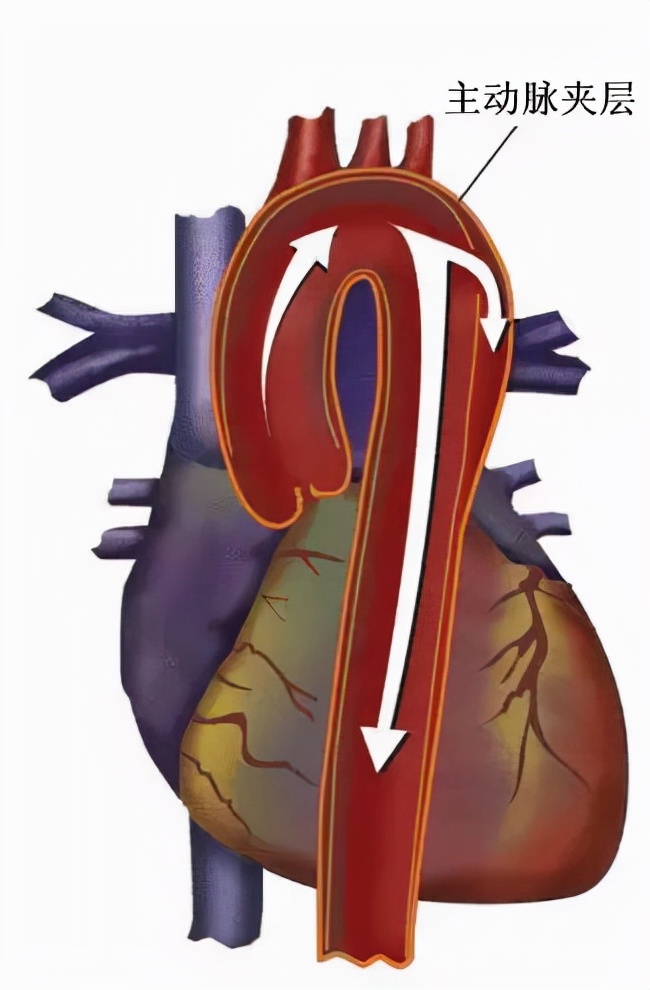 世上最痛的5种病，疼痛程度不亚于古代的酷刑，经历过的都是超人