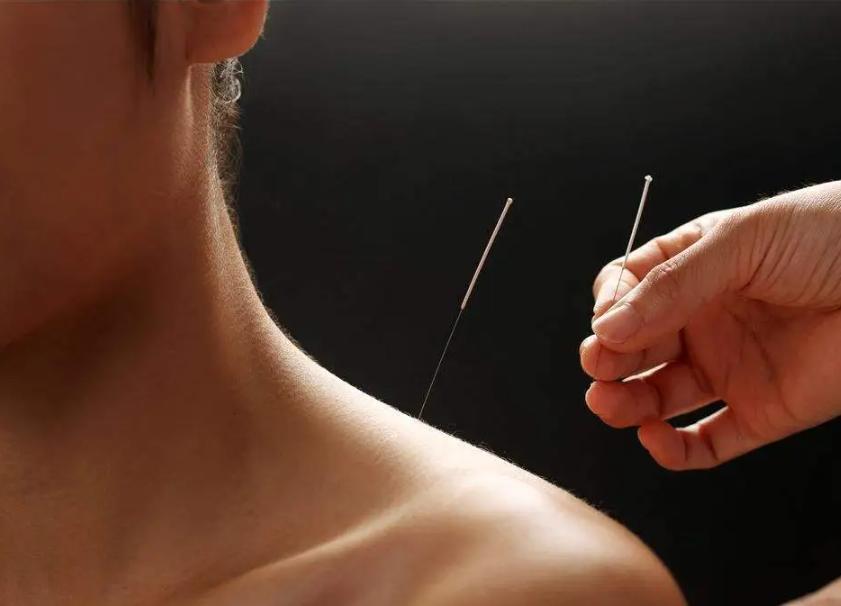 中医怎么治疗颈椎病有特效呢,中医临床诊断治疗颈椎病