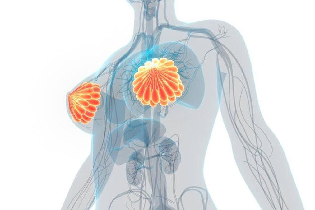 女子长期腿痛查出宫颈癌,女子患宫颈癌