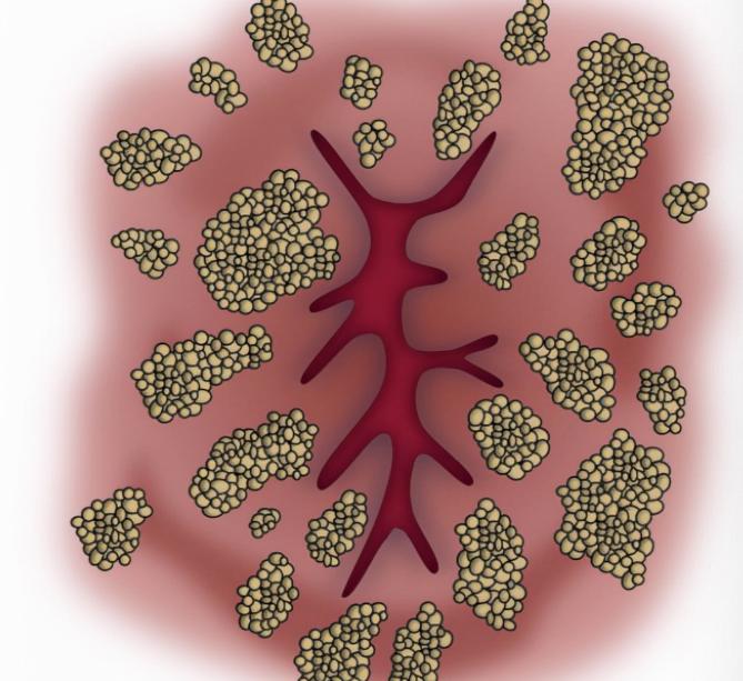 你洗屁屁吗？肛门也需要保护，医生：经常清洗肛门，预防这3种病